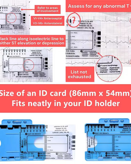 Regla de 7 pasos de Ecg / EKG para interpretación Analizador