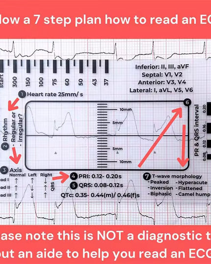 Regla de 7 pasos de Ecg / EKG para interpretación Analizador