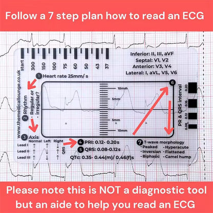 Regla de 7 pasos de Ecg / EKG para interpretación Analizador