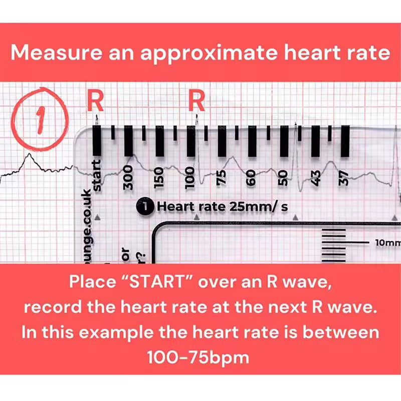 Regla de 7 pasos de Ecg / EKG para interpretación Analizador