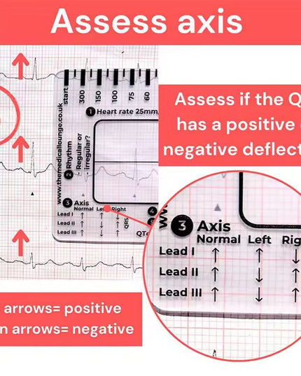 Regla de 7 pasos de Ecg / EKG para interpretación Analizador
