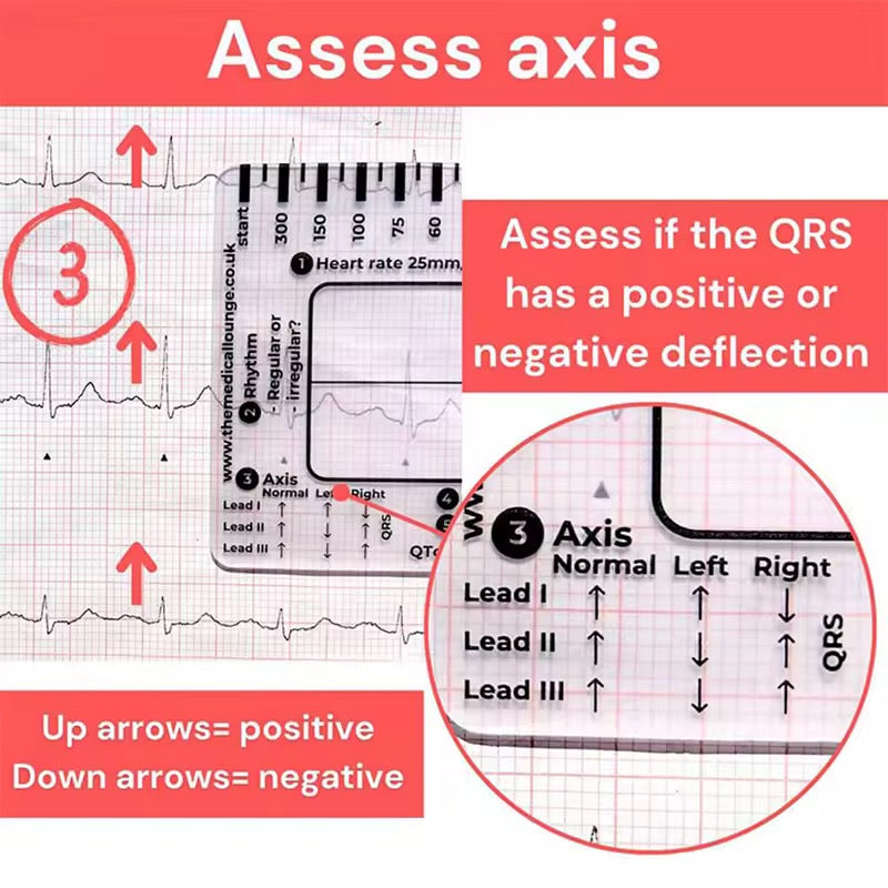 Regla de 7 pasos de Ecg / EKG para interpretación Analizador
