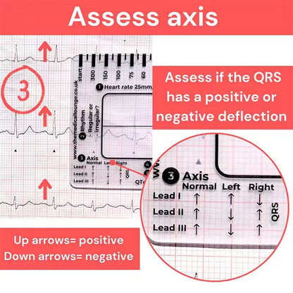 Regla de 7 pasos de Ecg / EKG para interpretación Analizador