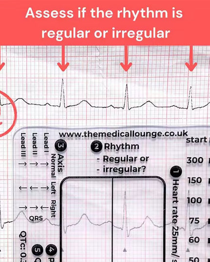 Regla de 7 pasos de Ecg / EKG para interpretación Analizador