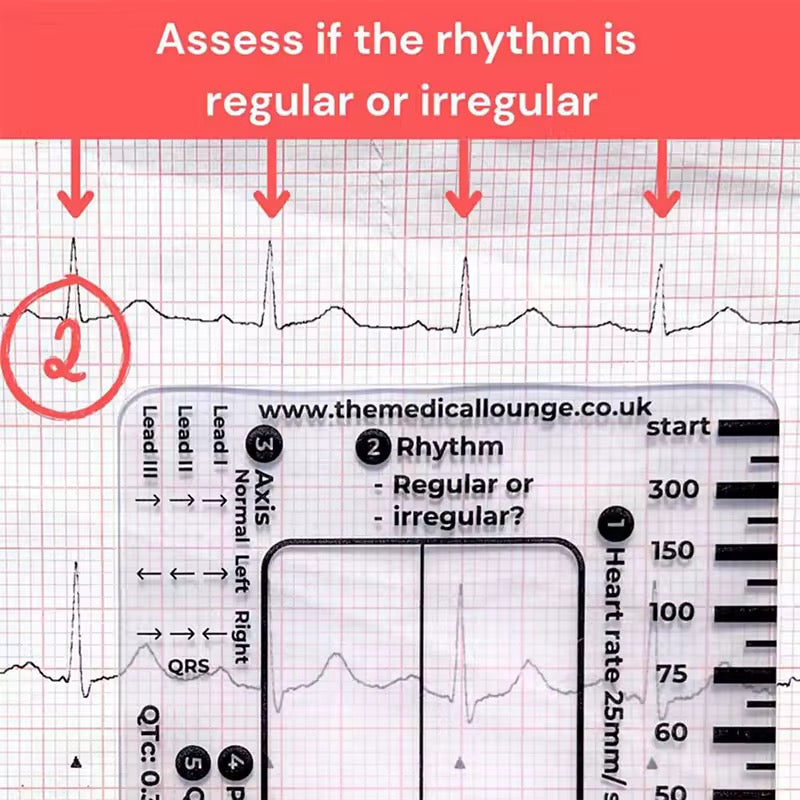 Regla de 7 pasos de Ecg / EKG para interpretación Analizador