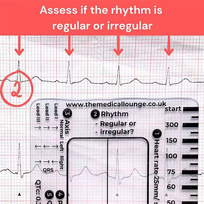 Regla de 7 pasos de Ecg / EKG para interpretación Analizador