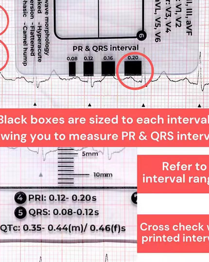 Regla de 7 pasos de Ecg / EKG para interpretación Analizador