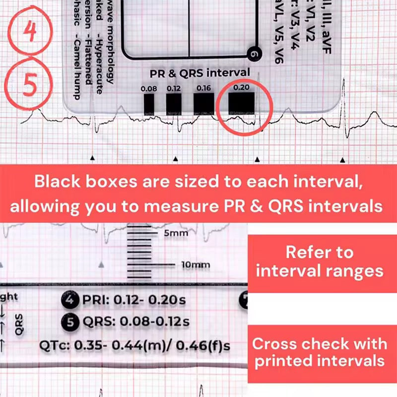 Regla de 7 pasos de Ecg / EKG para interpretación Analizador